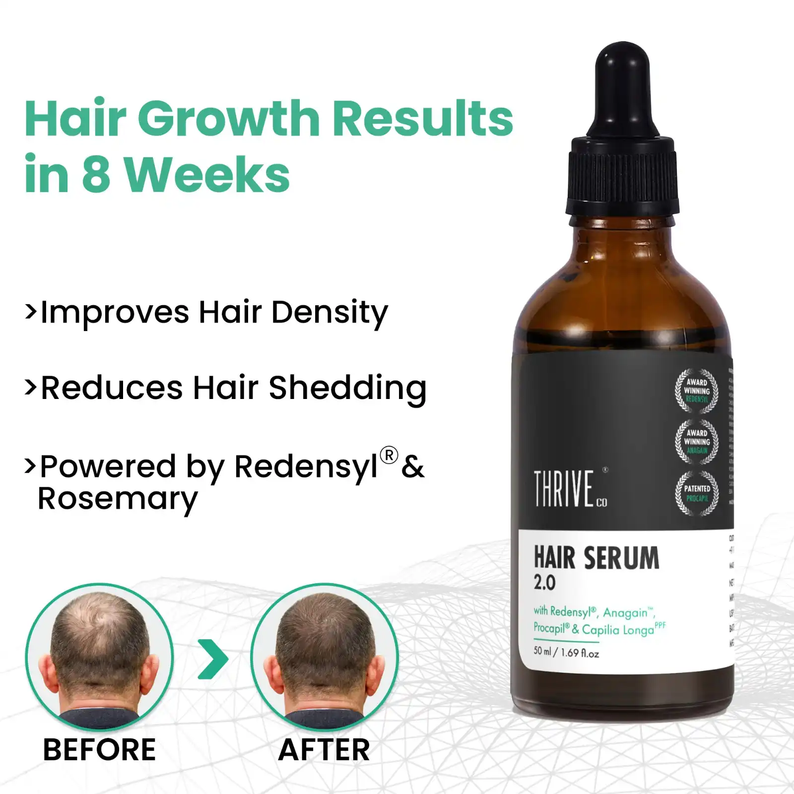 hair growth serum for men and women